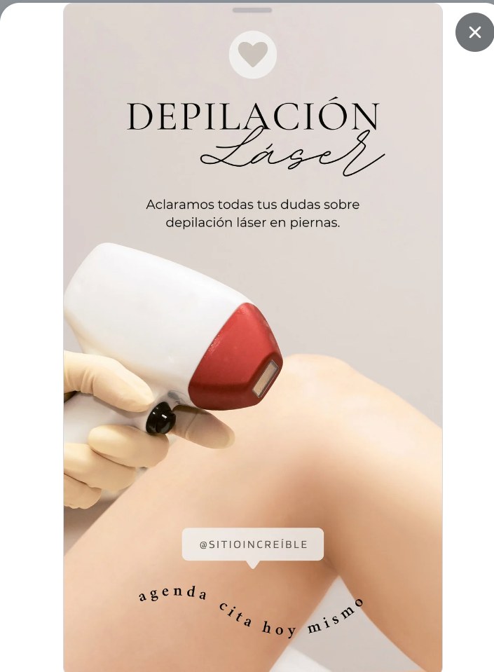 Depilación láser