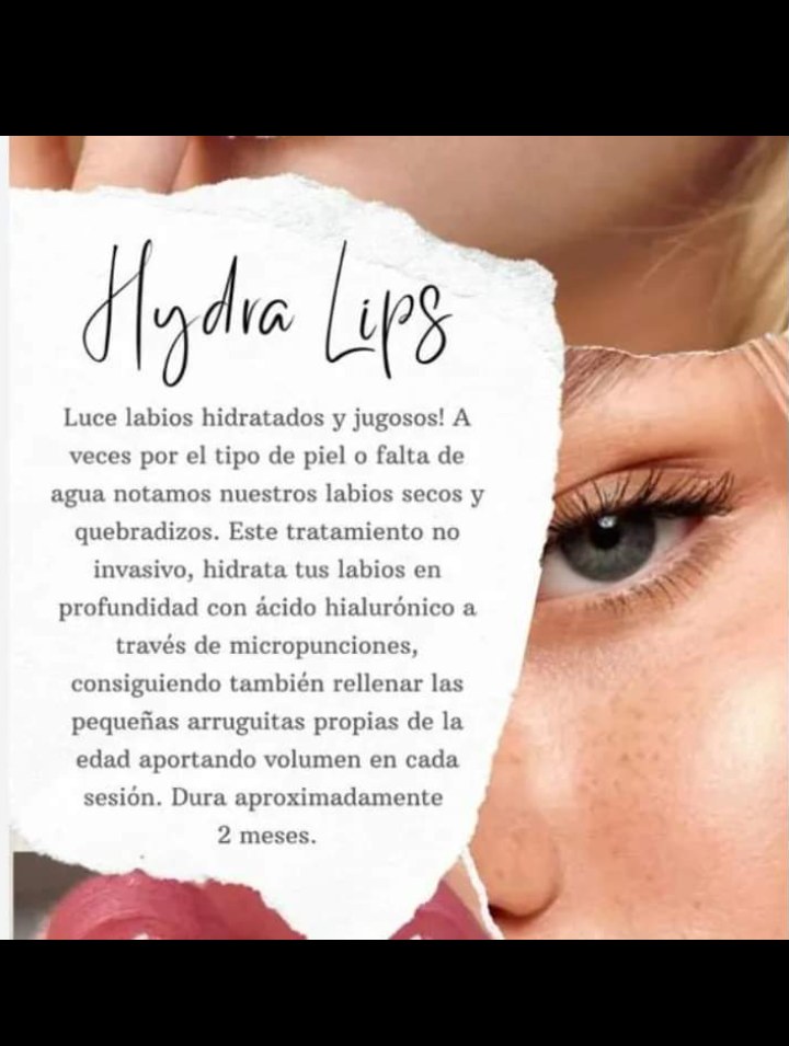 Hydra Lips